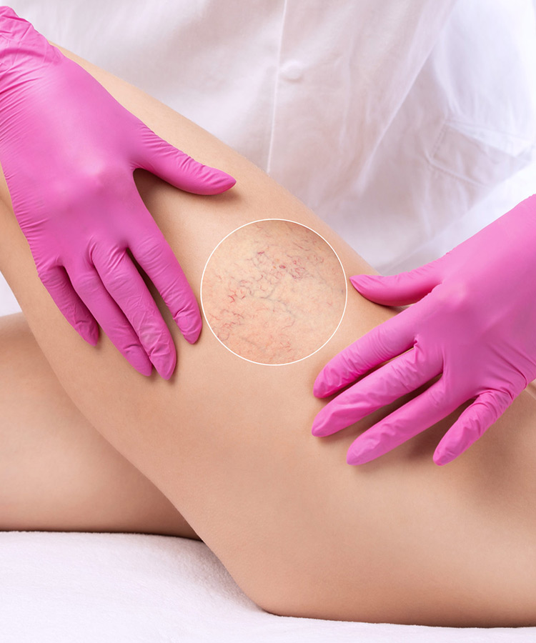 Sclerotherapy-Certificate-02 | Passion Beauty Academy