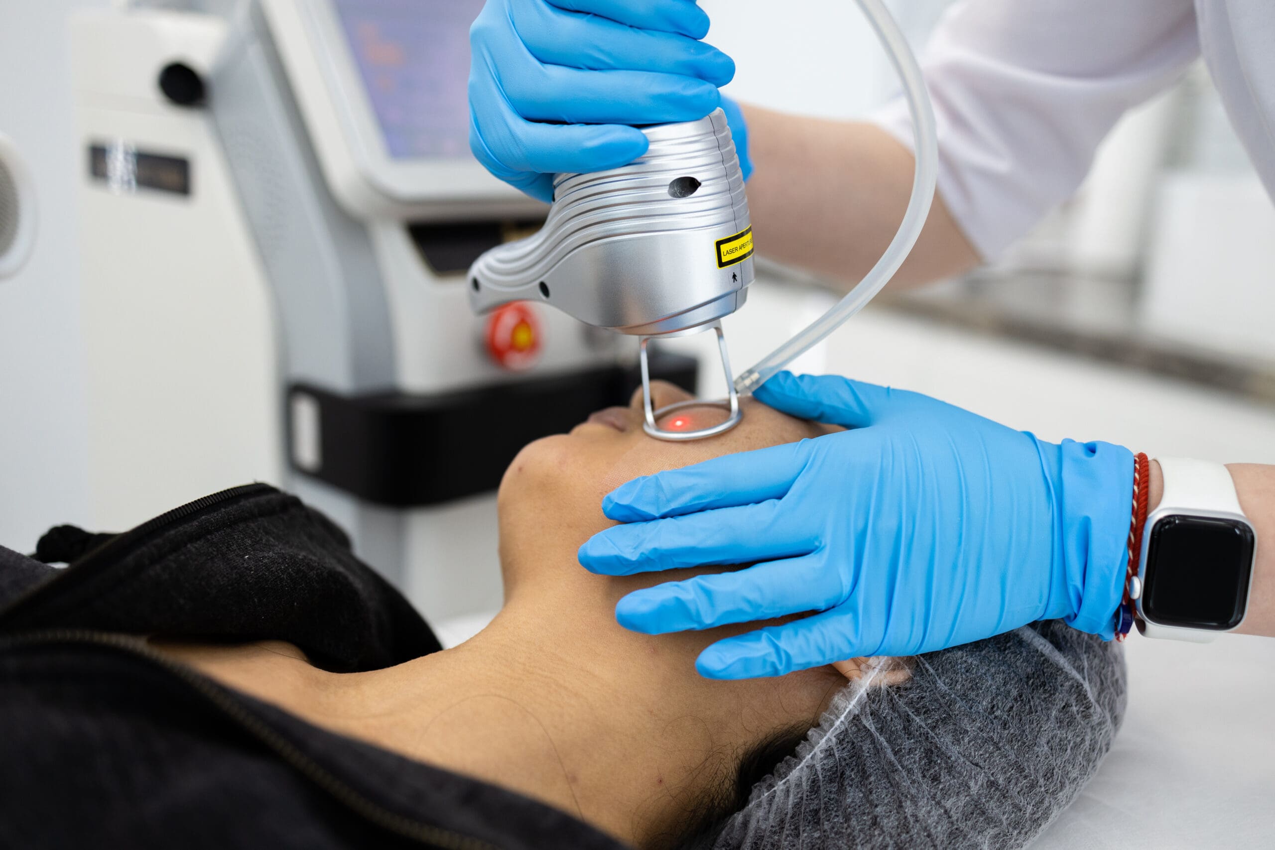 A medical aesthetician conducting a laser skin treatment in a clinical setting, using advanced technology for skin rejuvenation