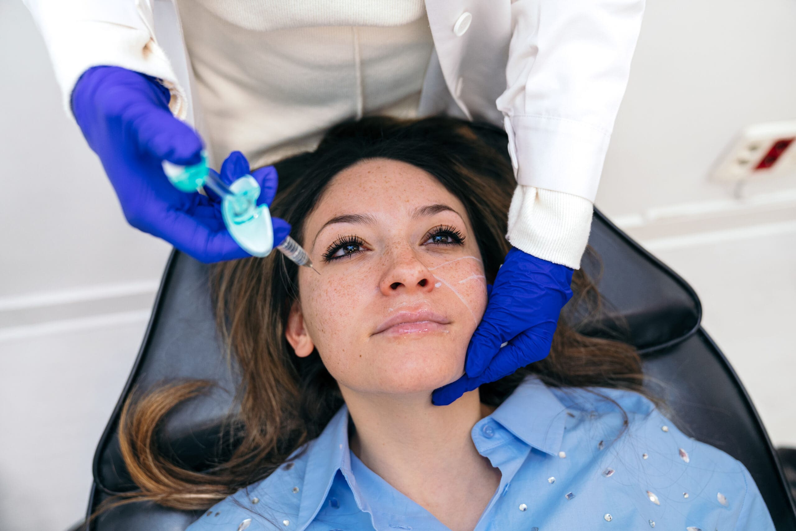 Expert Injector Applies Hyaluronic Filler Above Patients Upper Lip | Passion Beauty Academy Expert Botox and Filler Injector applies hyaluronic filler above patient's upper lip